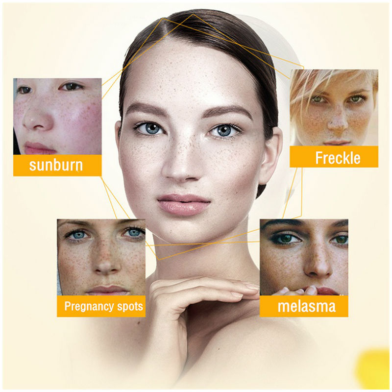 Dimollaure Whitening Freckle C - Beauty Glazed Makeup avaliação e preço